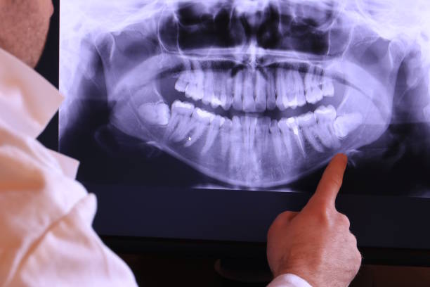 Best Emergency Treatment for Dental Infections or Abscesses in Holley, NY